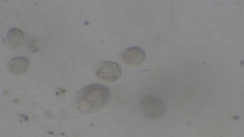Microscopy of protozoa microorganisms in the water sample, showing ciliates, paramecium, bacteria, spirochaete and algae. Motion of single-celled animals under microscope. 