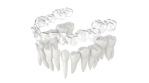 Clear aligner splint make teeth correction