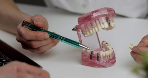 implantologist showing dental implant technology on tooth jaw model to patient