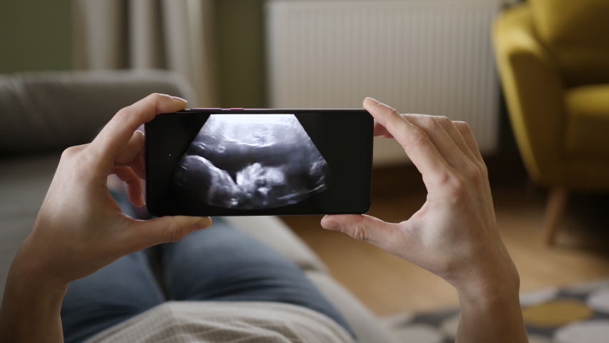 Third trimester pregnancy. Pregnant Woman Looking Ultrasound Video Her Baby on Mobile Phone. Pregnant Woman Looking at Ultrasound Scan on Smartphone Lying on Sofa at Home. Gynecology Birth Childbirth.