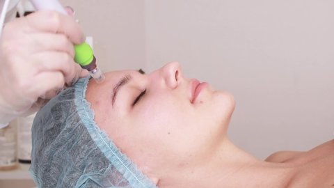 Fractional mesotherapy.A young beautiful woman in the cosmetologist’s office receives fractional mesotherapy for her face. Facial skin rejuvenation. Acne treatment. Hardware cosmetology. Beautician.