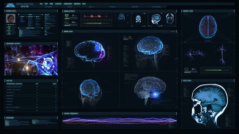 

Futuristic technological interface analyzing human brain anatomy and morphology. Medical profile of patient showing, brain lobes, head MRI scan, neuron cell animation and vital signs. Healthcare.