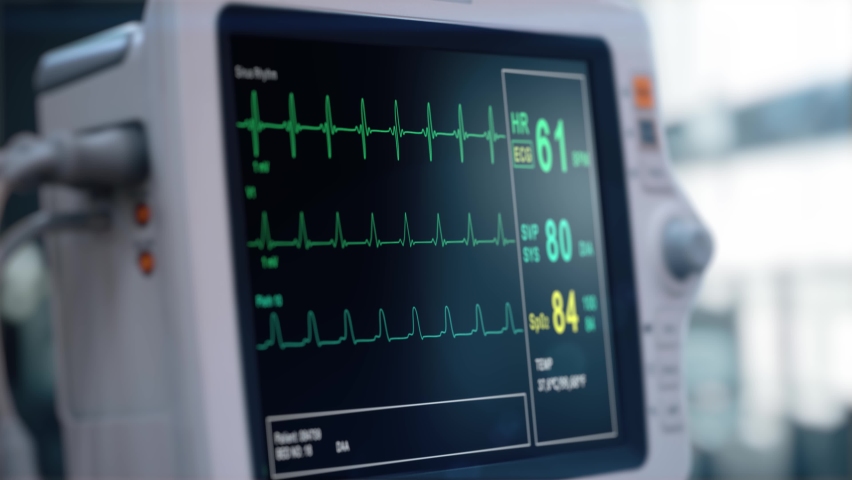 Heart rate monitor in hospital theater. Medical vital signs monitor instrument in a hospital on anesthesia surgery monitor. ECG. Patient heartbeat at the screen | Shutterstock HD Video #1063669639