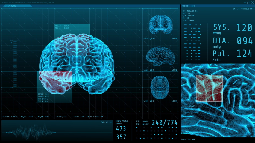 3D Rotating Brain Transparent Blue Wireframe Rotating With Alpha Loop, screen display vital signs with statistical data for neurology department on monitor, Hologram Futuristic Digital Technology Royalty-Free Stock Footage #1063807687