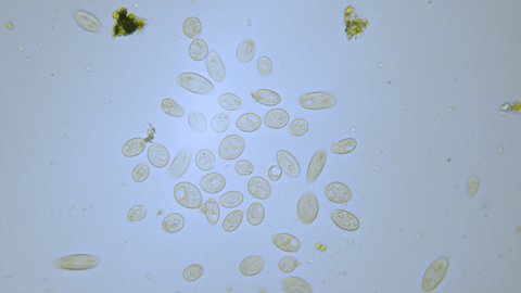Paramecium single cell organisms in microscope bright field