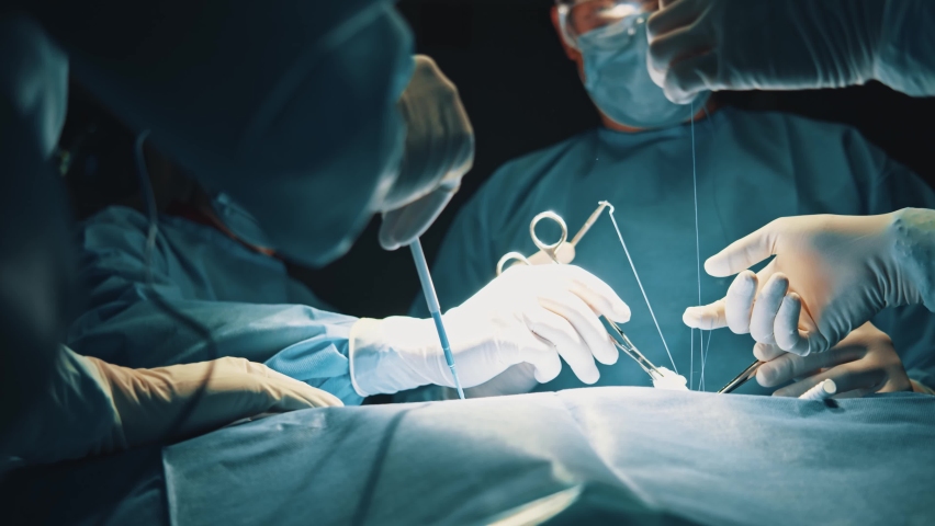 Group of medical workers in hospital room performing surgical operation. Patient undergoing open-chest surgery in operating room. Royalty-Free Stock Footage #1063930705