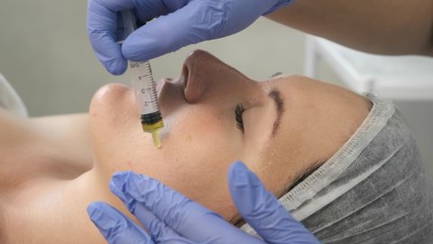 Beautician is making cure procedure on patient's face. Cosmetologist is applying yellow peeling on woman's face in beauty clinic. Doctor drops medicine on woman's cheek from a syringe.