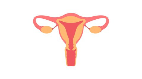 Uterus with endometriosis animation. Fertility, human anatomy, female reproductive system. Disease, gynecology, inflammation.
Outside tissue growth medical condition 