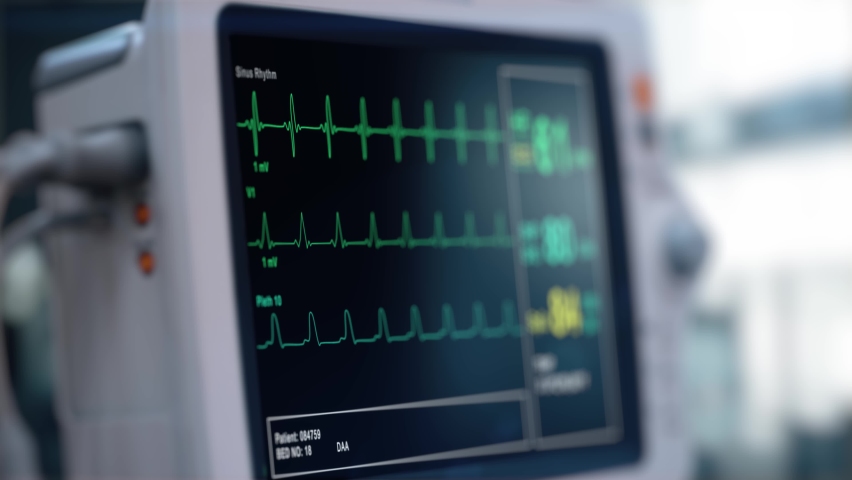 Heart rate monitor in hospital theater. Medical vital signs monitor instrument in a hospital on anesthesia surgery monitor. ECG. Patient heartbeat at the screen | Shutterstock HD Video #1064168653