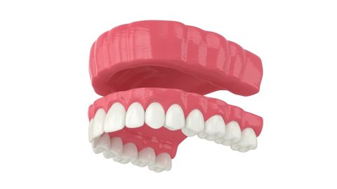 Removable traditional denture installation over white