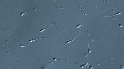 Human sperm for in vitro fertilization is analysed under a microscope for count and motility, as these can be reasons for sterility. Spermatozoan move thanks to their tails (flagella). 4K slow-mo.