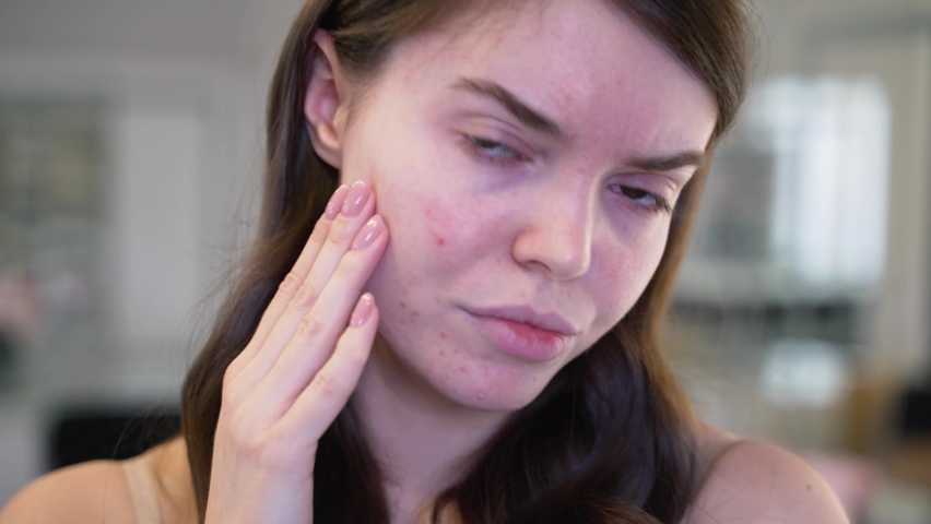 Girl with the problem of acne during puberty, looks at herself in the mirror. Close-up | Shutterstock HD Video #1064359858