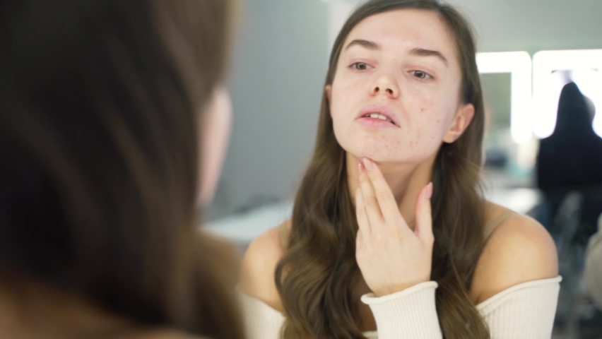 Girl with the problem of acne during puberty, looks at herself in the mirror. Close-up
