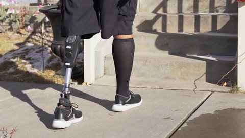 Black man walks up stairs with artificial prosthetic leg outside home