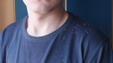 Man shaking off dandruff from clothes, close up