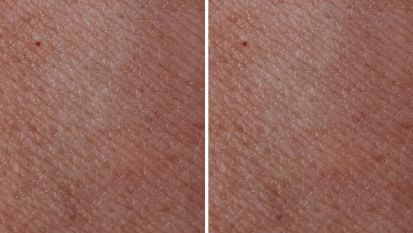 Side by side Close-up Brighten and Lighten Dull Skin texture | Shutterstock HD Video #1064894986