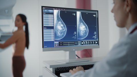 Computer Screen in Hospital Radiology Room: Beautiful Multiethnic Adult Woman Standing Topless Undergoing Mammography Screening Procedure. Screen Showing the Mammogram Scans of Dense Breast Tissues.
