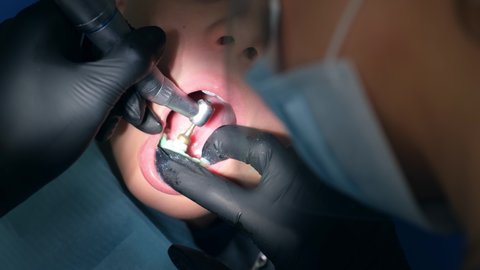 Dentist hygienist making oral hygienic cleaning in dentistry for teen child boy, mouth closeup. Using professional electrical dental drill machine to brush teeth in dentistry, visit doctor.
