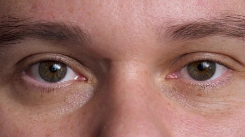 Male's hazel eyes, brown area surrounding pupil is iris. Wrinkle around eye is fold, ridge or crease on skin