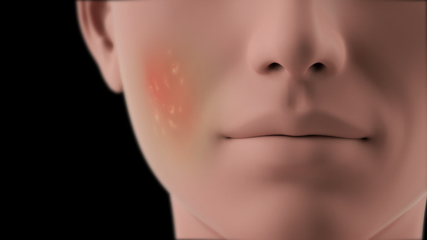 3D animation Face close-up repair effect skin dirt removal. Deep cleansing skin. Skin pores. Acne cleansing. skin pore cleaning Transparent Background
 | Shutterstock HD Video #1065438448
