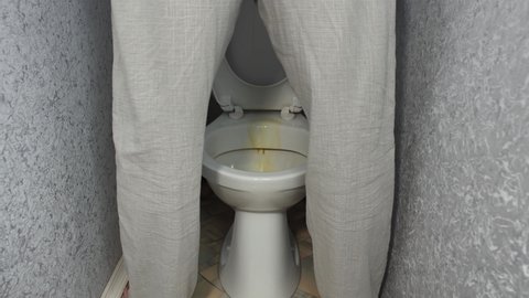 Elderly man with adenoma urinates standing up and stains edge of toilet bowl.