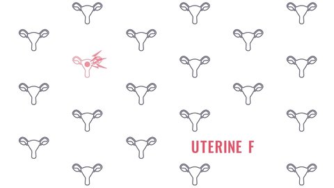 Uterus pattern cartoon animation for uterine fibroids awareness. Women health screening concept motion graphics. Myoma disease female medical diagnostic checkup. 