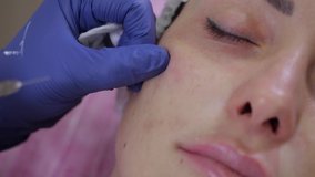 The beautician injects fillers based on hyaluronic acid to a young girl patient. Video for beauticians. Learning to conduct the procedure. High quality 4k footage