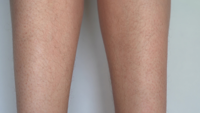 Closeup view 4k stock video footage of hairy female legs. Woman touching her body with hands. Fingernails with long ugly overgrown nails. Woman extremely need spa beauty procedures in cosmetic salon