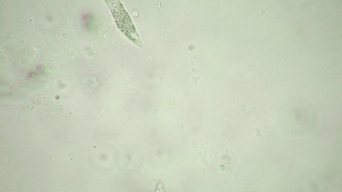 Astasia inflata, microscopic flagellate alga, x200 optical microscope