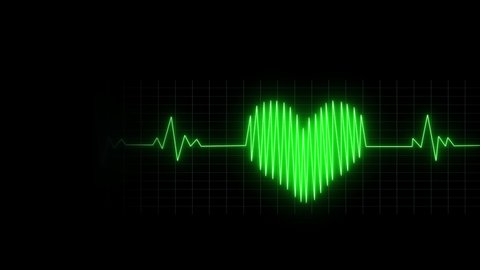 Heart Rhythm Background 4K Heartbeat monitor EKG line monitor shows heartthrob, Seamlessly loop electrocardiogram medical screen with a graph of heart rhythm on black background