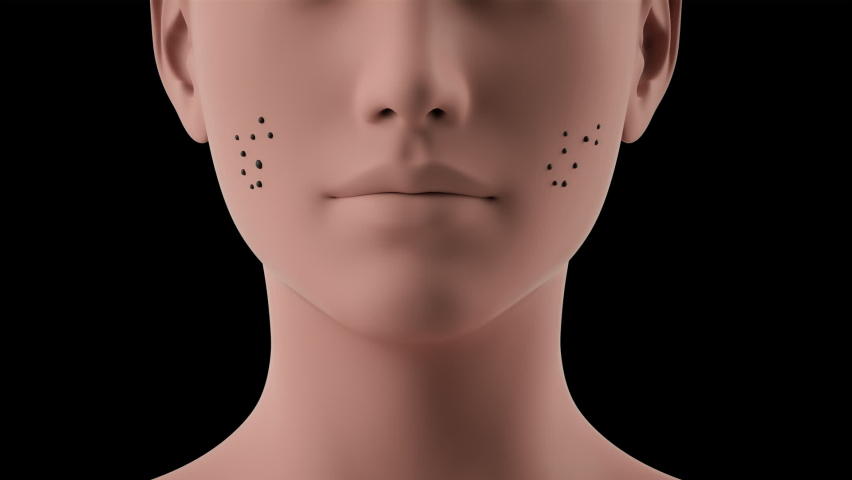
3D animation Face close-up repair effect skin dirt removal. Deep cleansing skin. Skin pores. Acne cleansing. skin pore cleaning Transparent Background Royalty-Free Stock Footage #1067005942