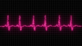 Ekg Heart Rhythm. 4K Heart Rhythm Video. Seamlessly loop electrocardiogram medical screen with a graph of heart rhythm on black background