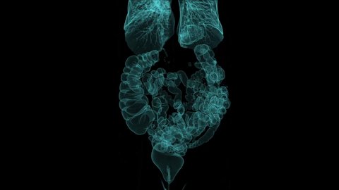 Body Ct Scan Image, Radiography X-Ray Examination, Mri Tomography. Virtual colonoscopy reconstruction