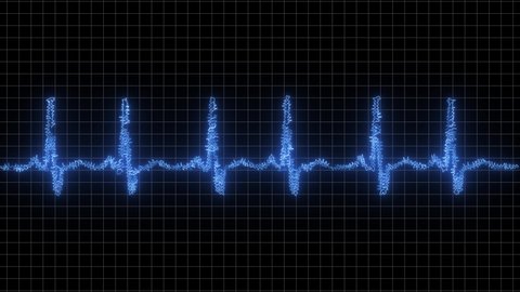 Ekg Heart Rhythm.4K Heart Rhythm Video. Seamlessly loop electrocardiogram medical screen with a graph of heart rhythm on black background