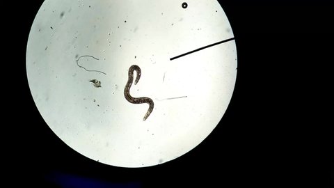 The nematode found in plant or soil under a microscope