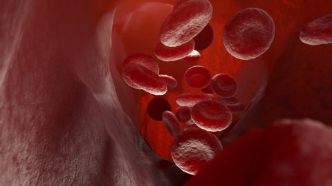 Cholesterol plaque in artery, Blood vessel with flowing blood cells. 3D animation