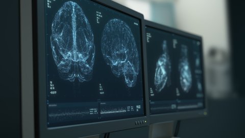 Heart and brain scanning data displayed on hospital monitors. Magnetic resonance, MRI. Disease diagnostics. Special medical equipment. ECG, CT. Computer tomography. Neurology, cardiology research. 3D