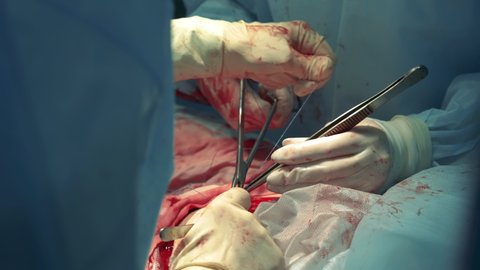 Patient's wound is getting sewn up during operation