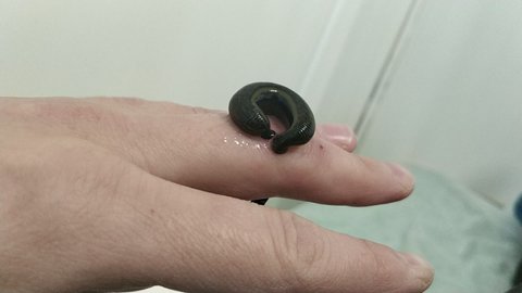 Treatment of a damaged finger joint with hirudotherapy. Leeches sucking blood on a human finger. Medicine concept 