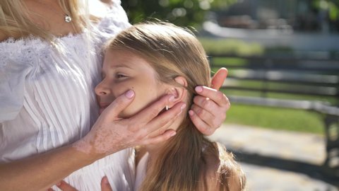 Close-up of caring female hands with vitiligo spots gently stroking face of happy preteen daughter during joint leisure in city park. Smiling girl putting head on mother's chest enjoying her caress