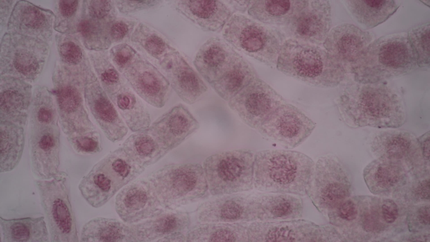 Root tip of Onion and Mitosis cell in the Root tip of Onion under a microscope.
