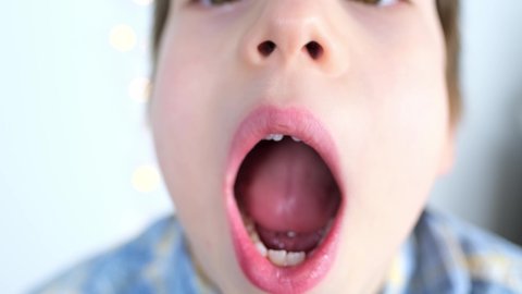 small child, kid performs articulation exercises for mouth, rolls the tongue into a tube, oral cavity, close-up, vocals, dental concept, speech therapy