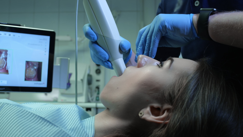 Doctor scans the patient's teeth in the clinic. The dentist holds in his hand a manual 3D scanner for the jaw and mouth. Dental health. Creates a 3D model of teeth and gums on a medical monitor. Royalty-Free Stock Footage #1068781226