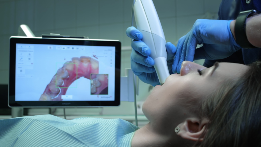 Doctor scans the patient's teeth in the clinic. The dentist holds in his hand a manual 3D scanner for the jaw and mouth. Dental health. Creates a 3D model of teeth and gums on a medical monitor. Royalty-Free Stock Footage #1068781226