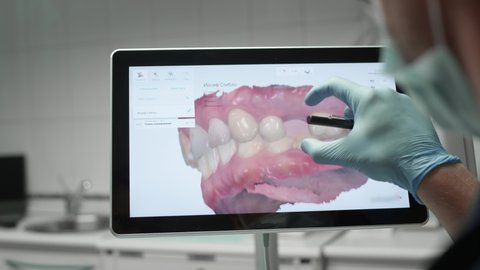 A professional dentist man looks at a 3d model of teeth on a computer monitor. Dental consultation, diagnostics. Jaw scan, digital imprint, medical digital technology.