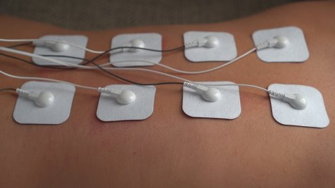 Woman doing electrical stimulation massage on her back Tens. Physiotherapeutic procedures, massage and restoration with an electric device