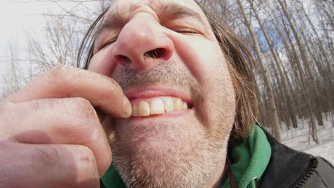 Funny and disgusting man trying to get stuck food from his teeth
