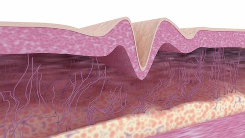Wrinkle smoothing. Medical 3d animation showing a process of skin rejuvenation, the rebuilding of collagen and elastin fibers, wrinkles removing and skin tightening. The effect of anti-aging treatment