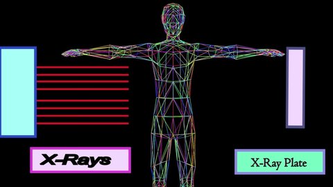 How Xrays Pass Through Human Body Stock Footage Video (100% Royalty ...