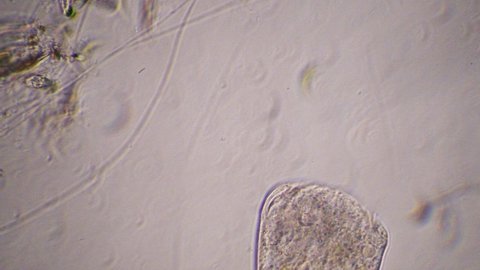Vorticella is a genus of bell-shaped ciliates, protozoa